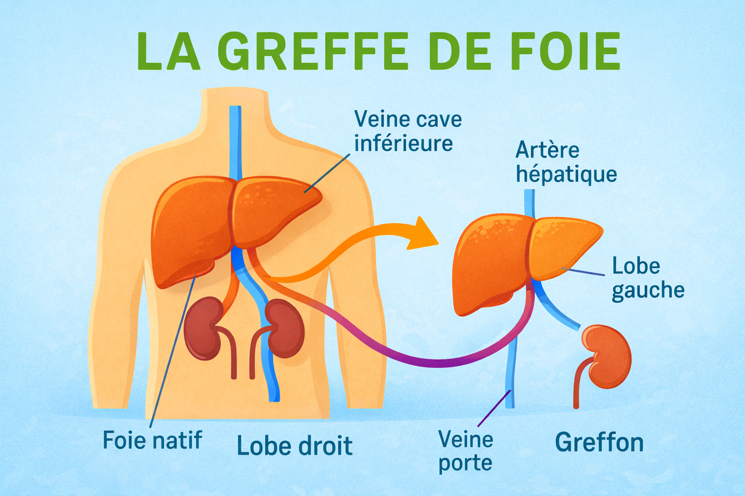 Lire la suite à propos de l’article La greffe