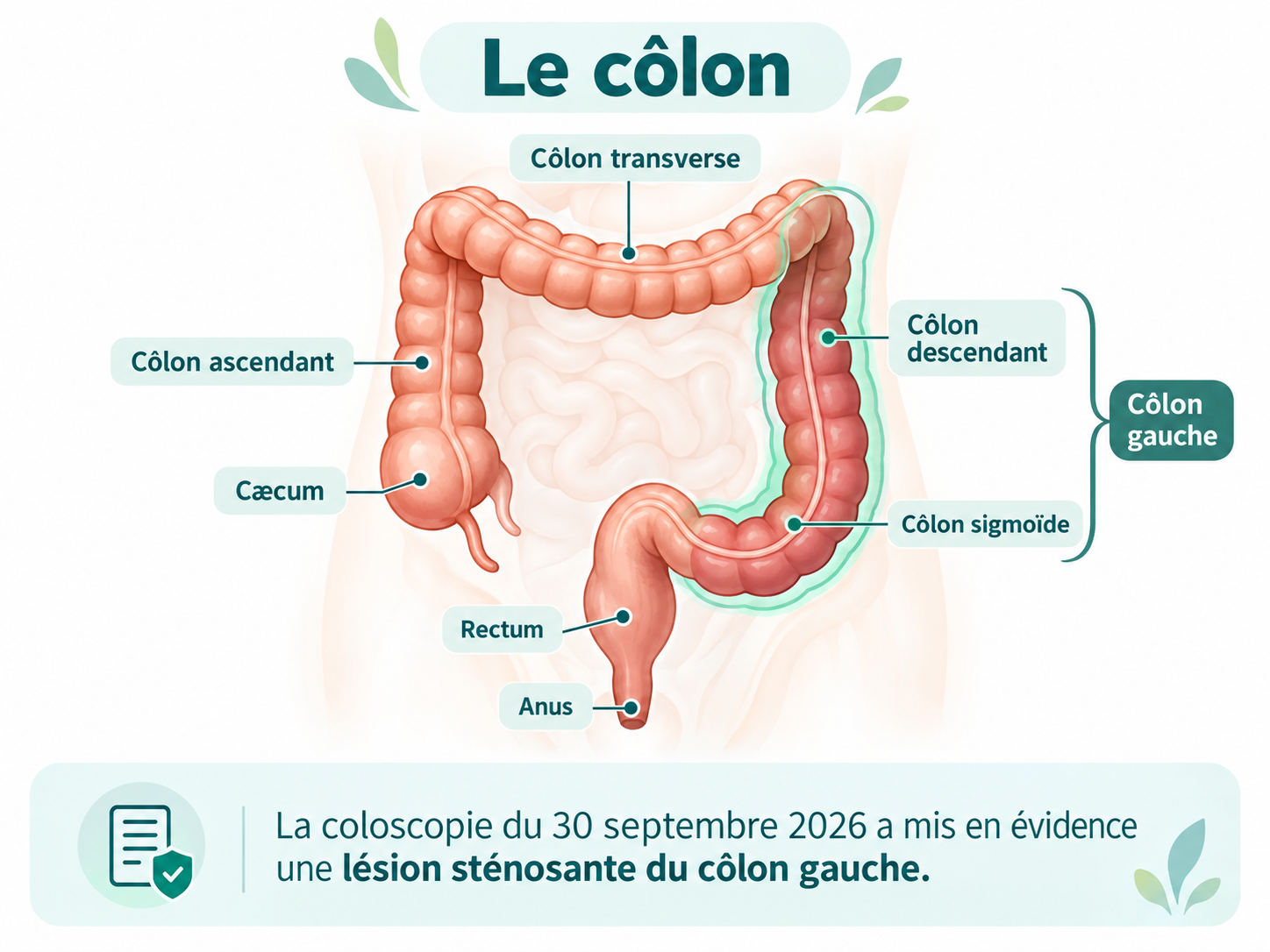 Lire la suite à propos de l’article Le côlon